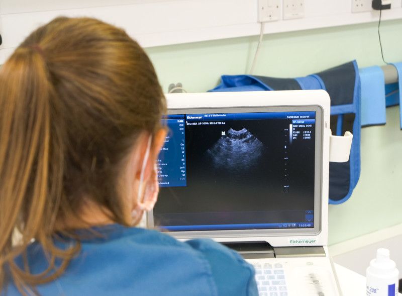 Nurse looking at ultrasound display